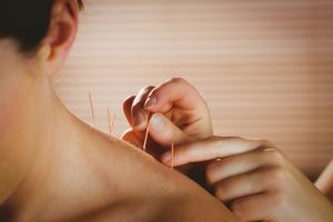 Jersey City cancer pain treatment with acupuncture